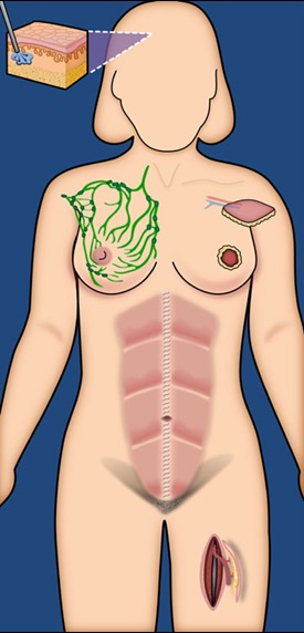 Figure Diagram